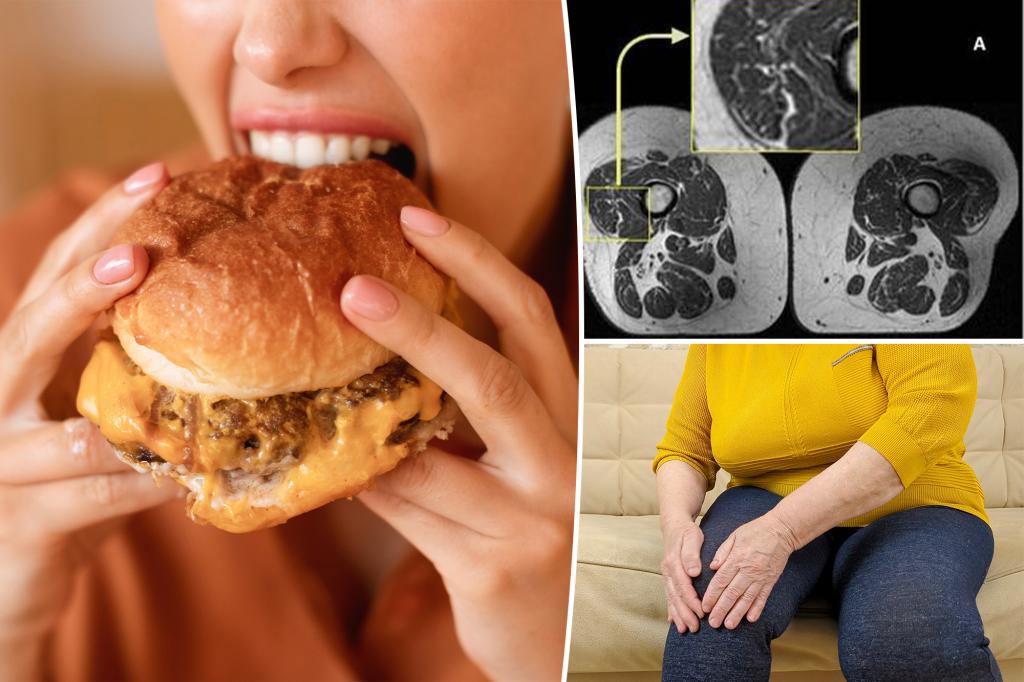 Junk food linked to higher risk of bone disease in new study